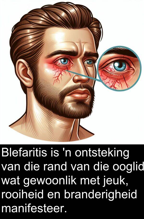 rooiheid: Blefaritis is 'n ontsteking van die rand van die ooglid wat gewoonlik met jeuk, rooiheid en branderigheid manifesteer.