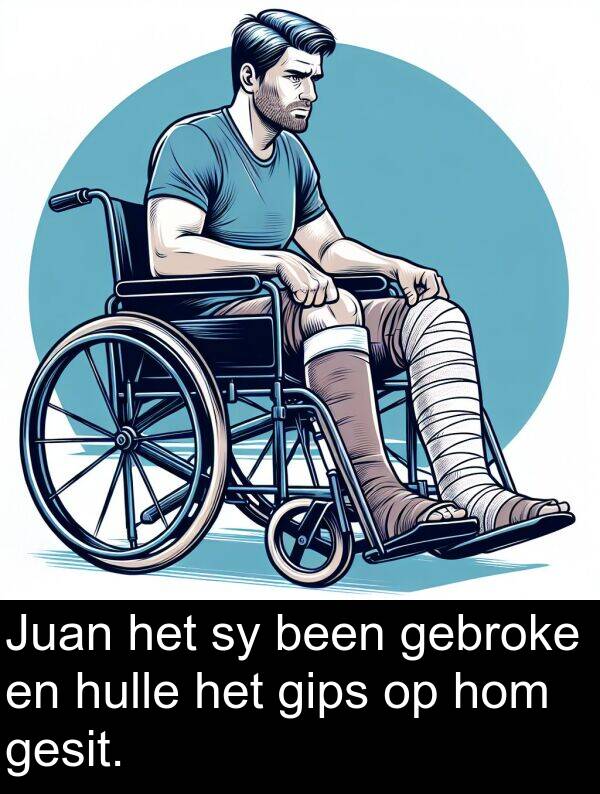 gebroke: Juan het sy been gebroke en hulle het gips op hom gesit.