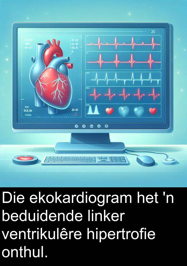 hipertrofie: Die ekokardiogram het 'n beduidende linker ventrikulêre hipertrofie onthul.