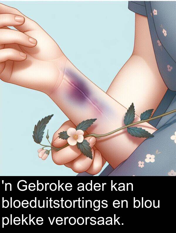 plekke: 'n Gebroke ader kan bloeduitstortings en blou plekke veroorsaak.