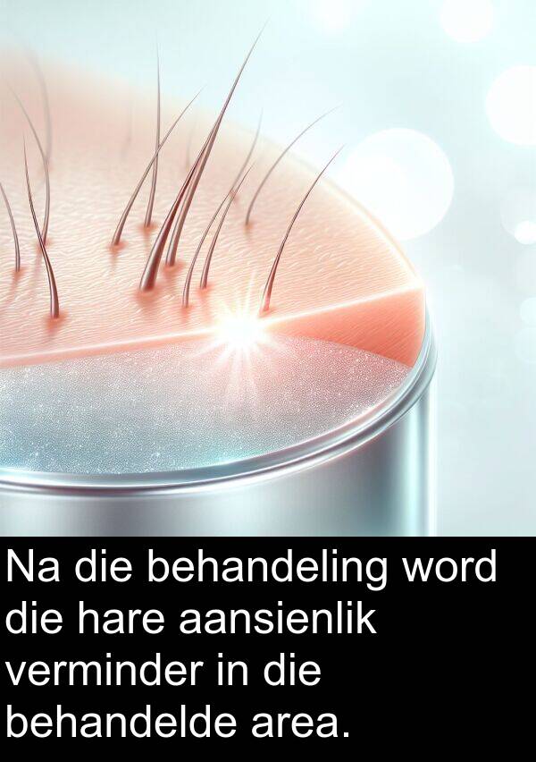 aansienlik: Na die behandeling word die hare aansienlik verminder in die behandelde area.