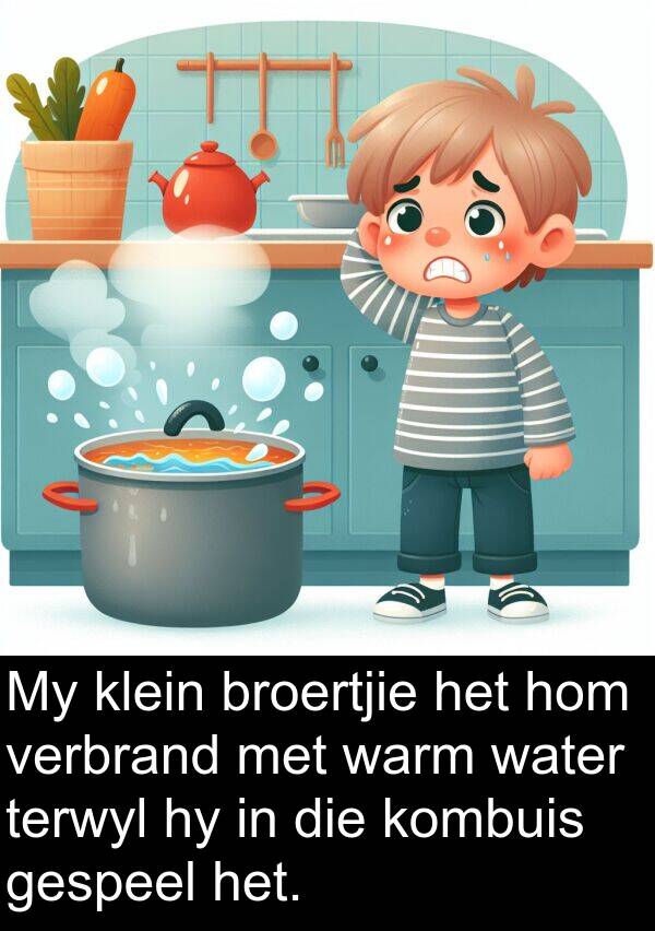 warm: My klein broertjie het hom verbrand met warm water terwyl hy in die kombuis gespeel het.