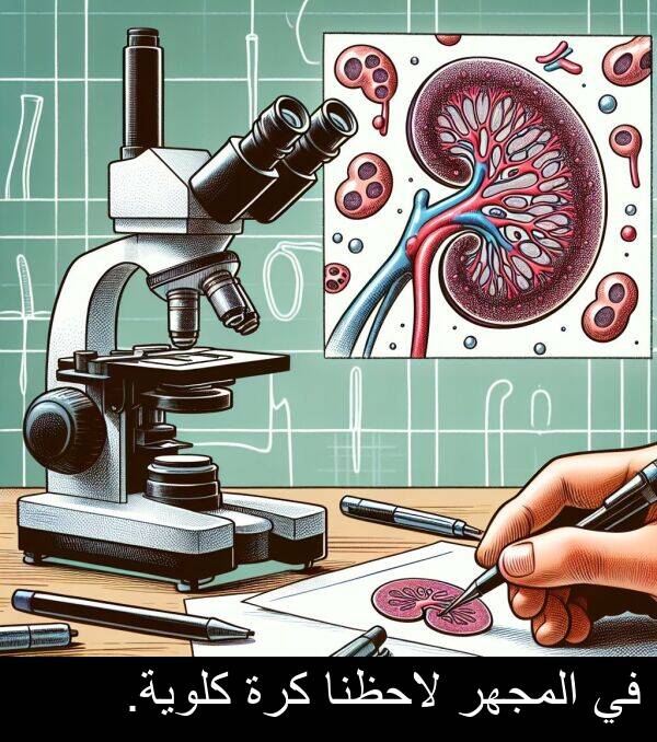 لاحظنا: في المجهر لاحظنا كرة كلوية.