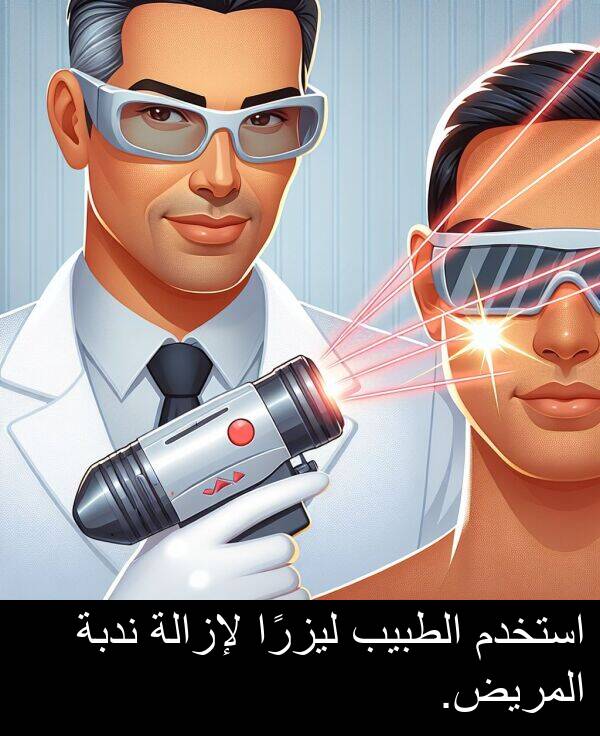لإزالة: استخدم الطبيب ليزرًا لإزالة ندبة المريض.