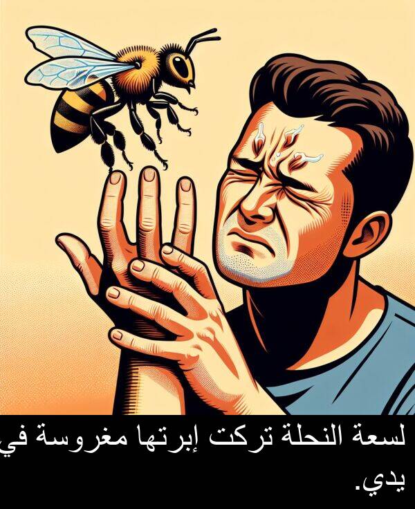يدي: لسعة النحلة تركت إبرتها مغروسة في يدي.