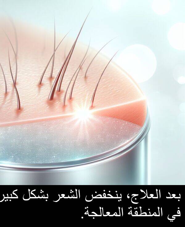 المعالجة: بعد العلاج، ينخفض الشعر بشكل كبير في المنطقة المعالجة.
