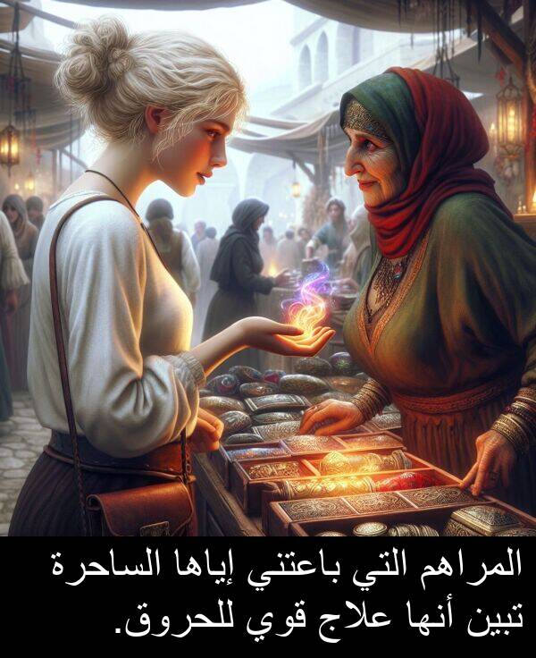 إياها: المراهم التي باعتني إياها الساحرة تبين أنها علاج قوي للحروق.