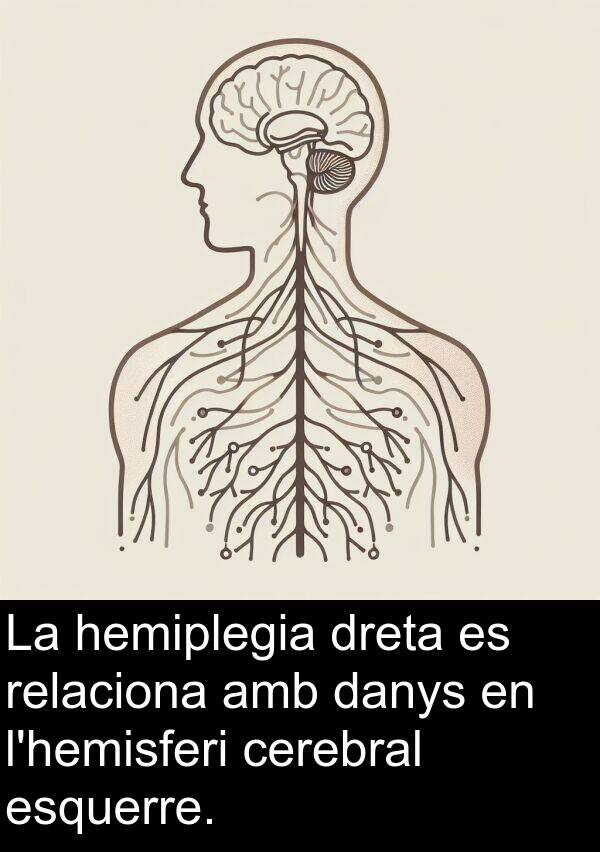 esquerre: La hemiplegia dreta es relaciona amb danys en l'hemisferi cerebral esquerre.