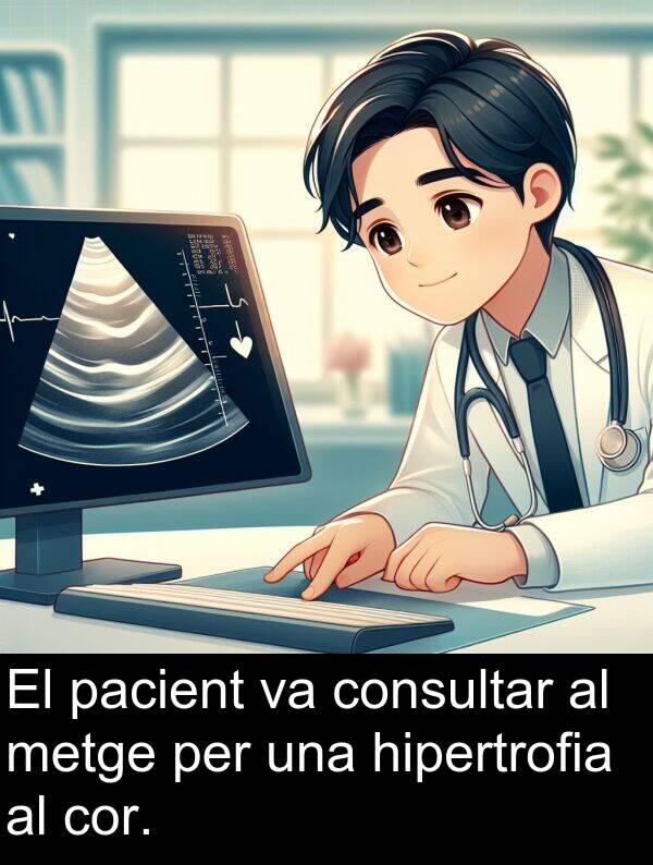 hipertrofia: El pacient va consultar al metge per una hipertrofia al cor.
