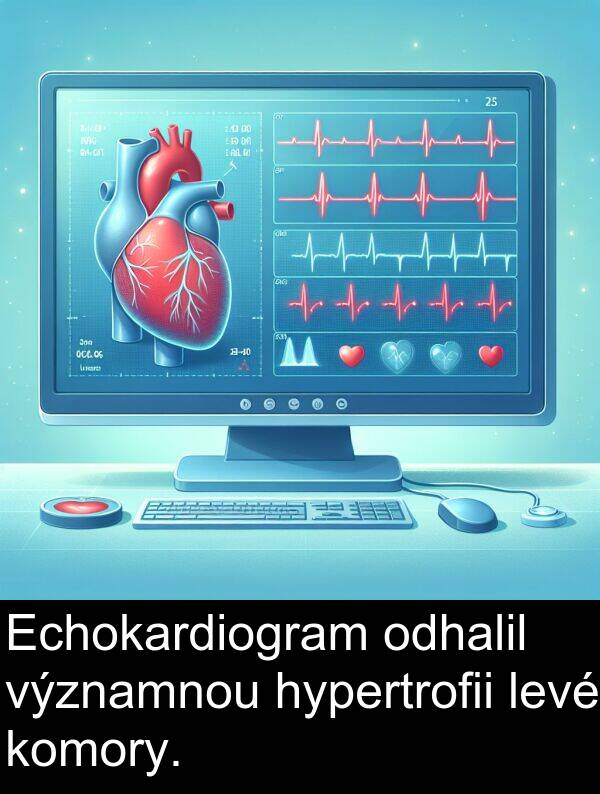 odhalil: Echokardiogram odhalil významnou hypertrofii levé komory.
