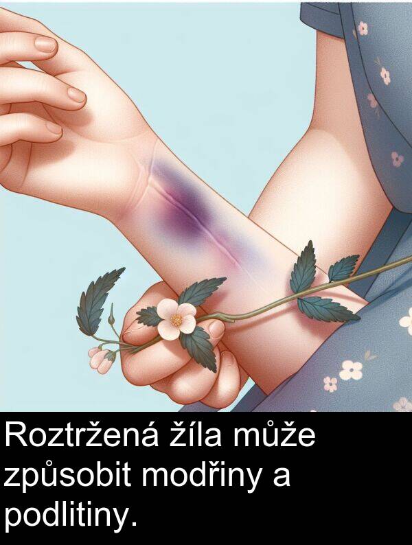 žíla: Roztržená žíla může způsobit modřiny a podlitiny.