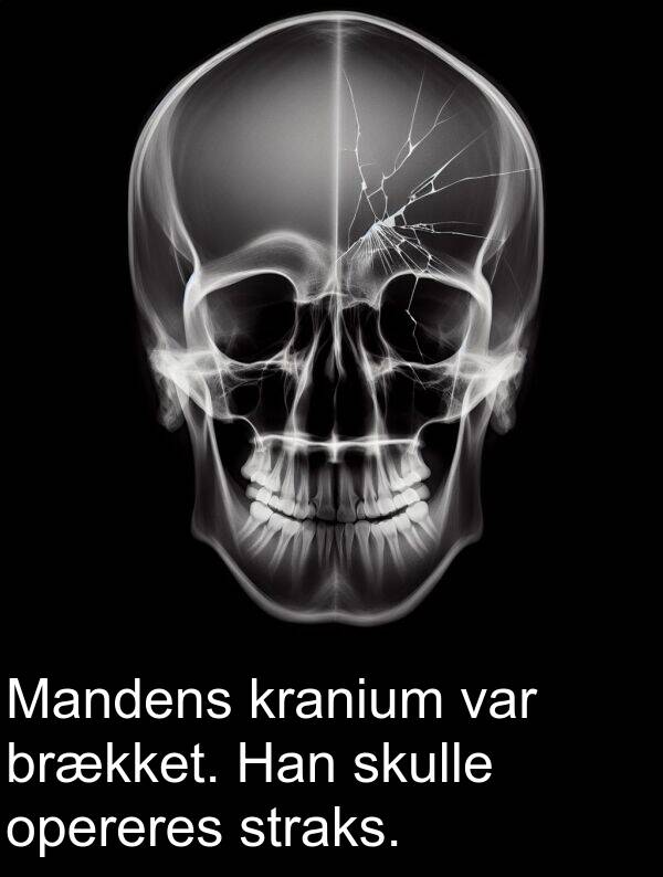 skulle: Mandens kranium var brækket. Han skulle opereres straks.