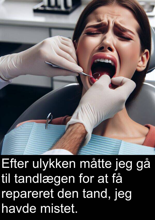 mistet: Efter ulykken måtte jeg gå til tandlægen for at få repareret den tand, jeg havde mistet.