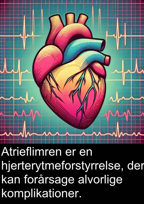komplikationer: Atrieflimren er en hjerterytmeforstyrrelse, der kan forårsage alvorlige komplikationer.
