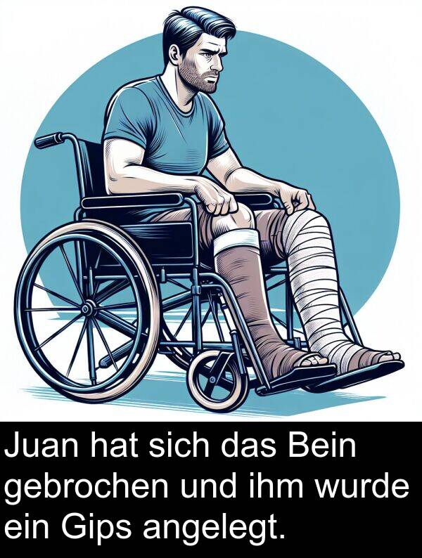 wurde: Juan hat sich das Bein gebrochen und ihm wurde ein Gips angelegt.