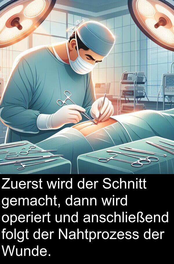 dann: Zuerst wird der Schnitt gemacht, dann wird operiert und anschließend folgt der Nahtprozess der Wunde.