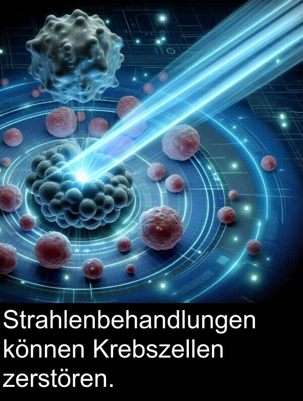 Strahlenbehandlungen: Strahlenbehandlungen können Krebszellen zerstören.