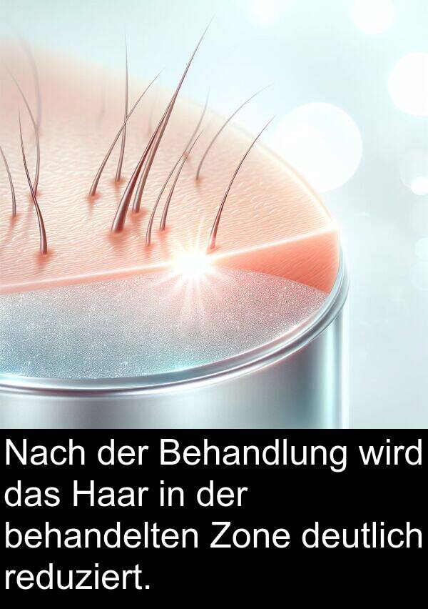 deutlich: Nach der Behandlung wird das Haar in der behandelten Zone deutlich reduziert.