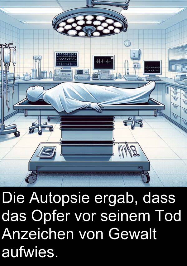 Anzeichen: Die Autopsie ergab, dass das Opfer vor seinem Tod Anzeichen von Gewalt aufwies.