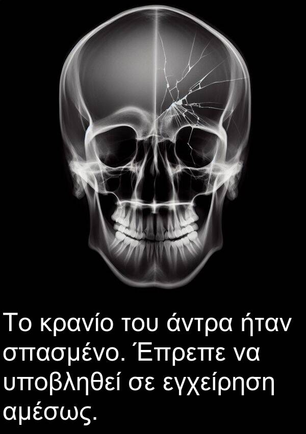 εγχείρηση: Το κρανίο του άντρα ήταν σπασμένο. Έπρεπε να υποβληθεί σε εγχείρηση αμέσως.