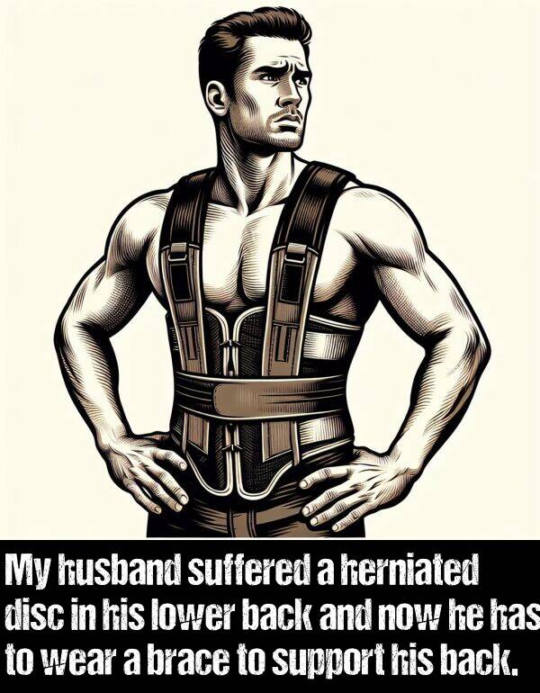 back: My husband suffered a herniated disc in his lower back and now he has to wear a brace to support his back.
