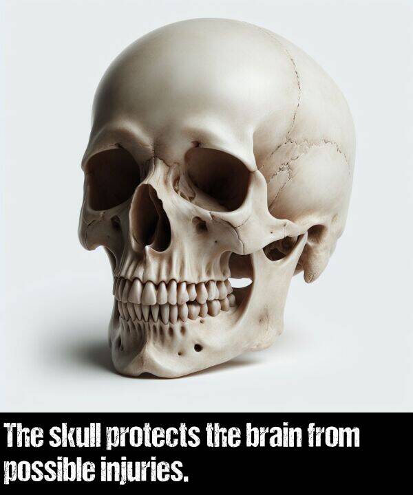 brain: The skull protects the brain from possible injuries.