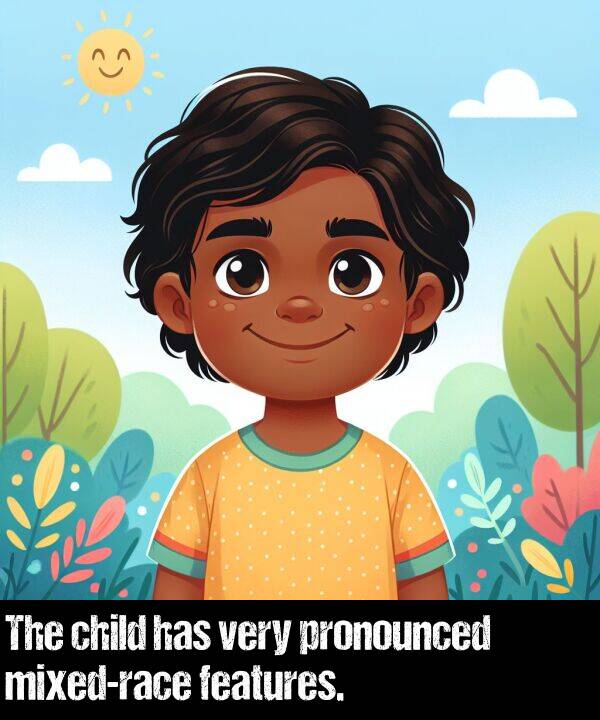 features: The child has very pronounced mixed-race features.