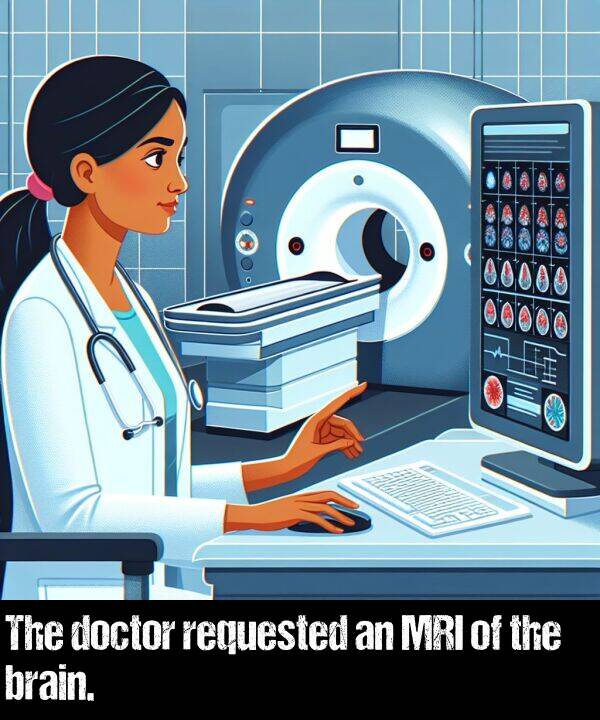 brain: The doctor requested an MRI of the brain.