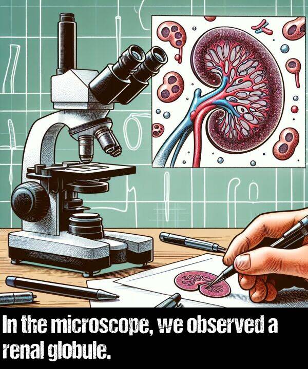 observed: In the microscope, we observed a renal globule.