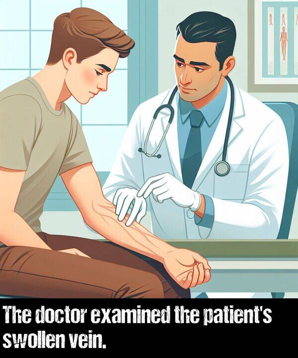 vein: The doctor examined the patient's swollen vein.