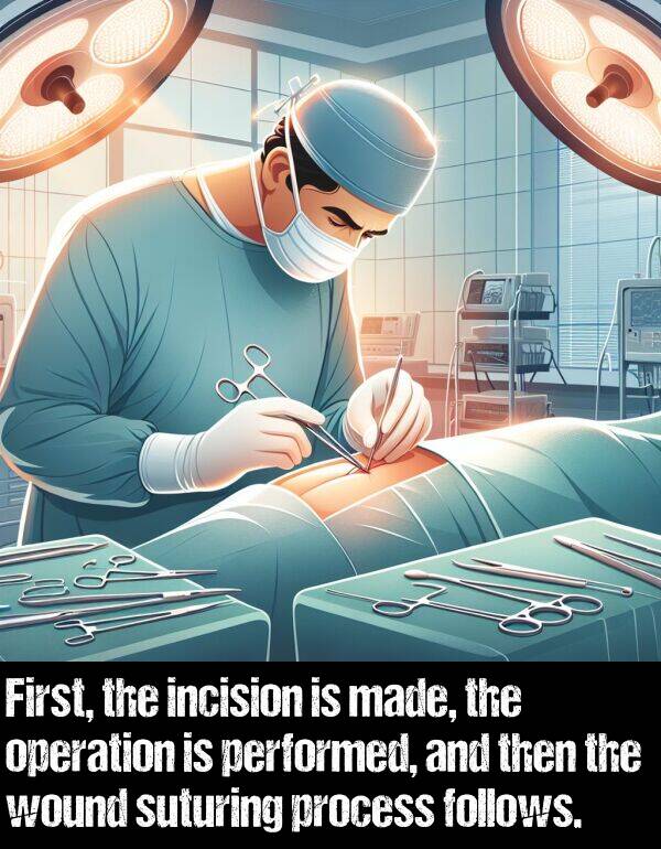operation: First, the incision is made, the operation is performed, and then the wound suturing process follows.