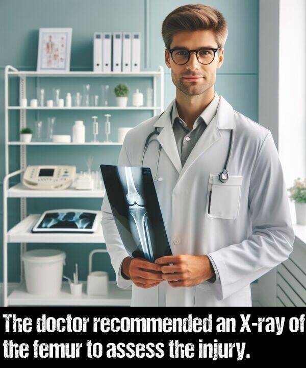 femur: The doctor recommended an X-ray of the femur to assess the injury.