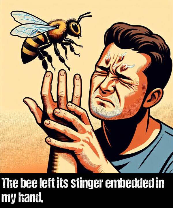 left: The bee left its stinger embedded in my hand.
