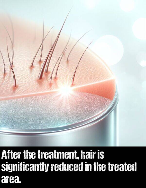 area: After the treatment, hair is significantly reduced in the treated area.