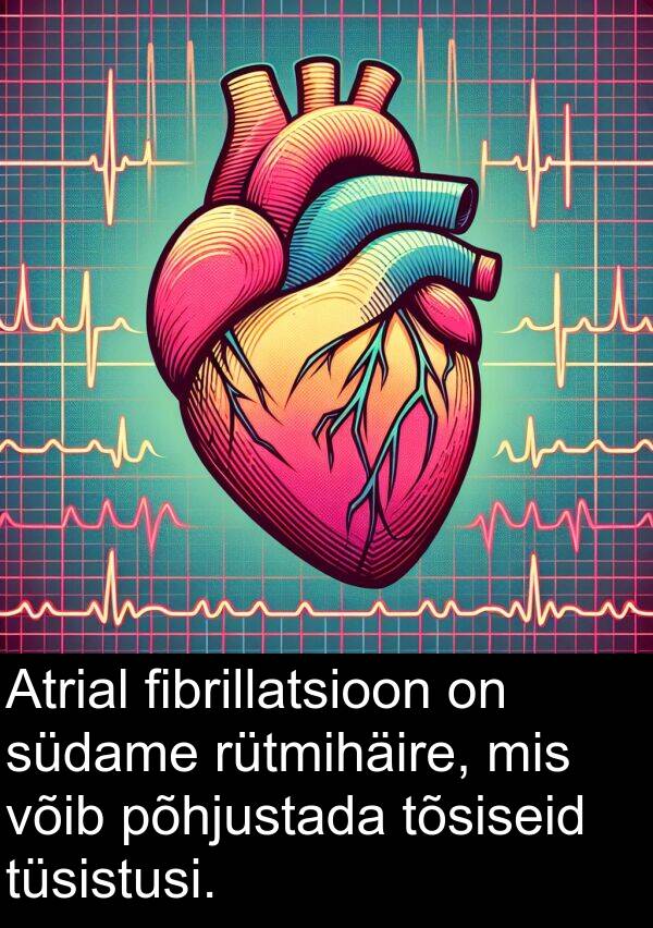 fibrillatsioon: Atrial fibrillatsioon on südame rütmihäire, mis võib põhjustada tõsiseid tüsistusi.