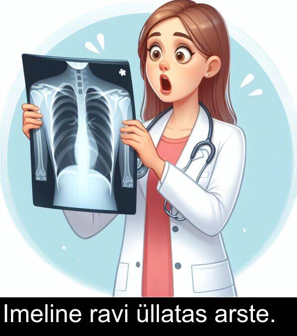 arste: Imeline ravi üllatas arste.
