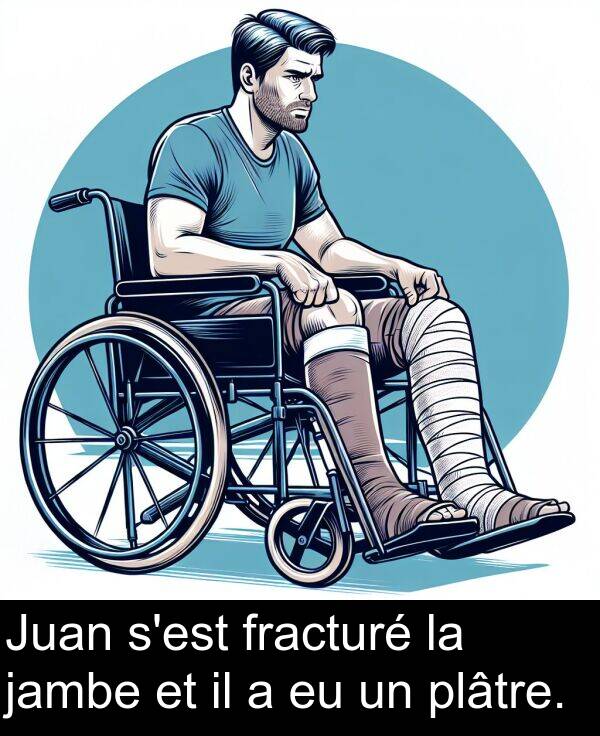 jambe: Juan s'est fracturé la jambe et il a eu un plâtre.