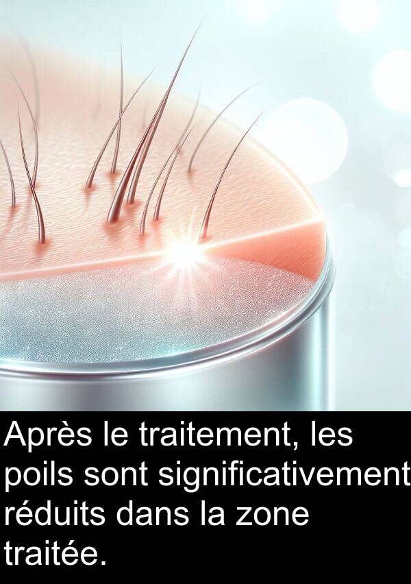 zone: Après le traitement, les poils sont significativement réduits dans la zone traitée.
