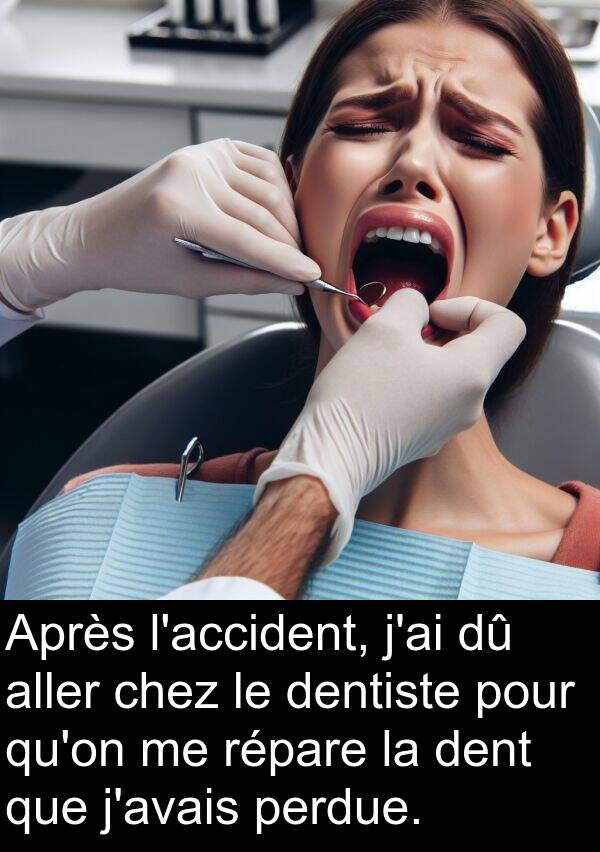 répare: Après l'accident, j'ai dû aller chez le dentiste pour qu'on me répare la dent que j'avais perdue.