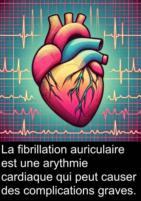 fibrillation: La fibrillation auriculaire est une arythmie cardiaque qui peut causer des complications graves.