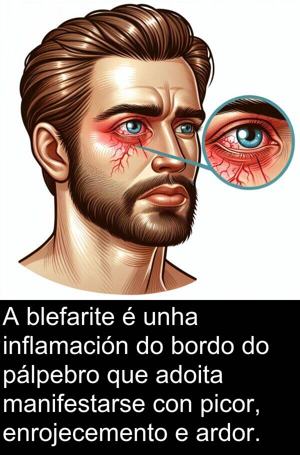 enrojecemento: A blefarite é unha inflamación do bordo do pálpebro que adoita manifestarse con picor, enrojecemento e ardor.