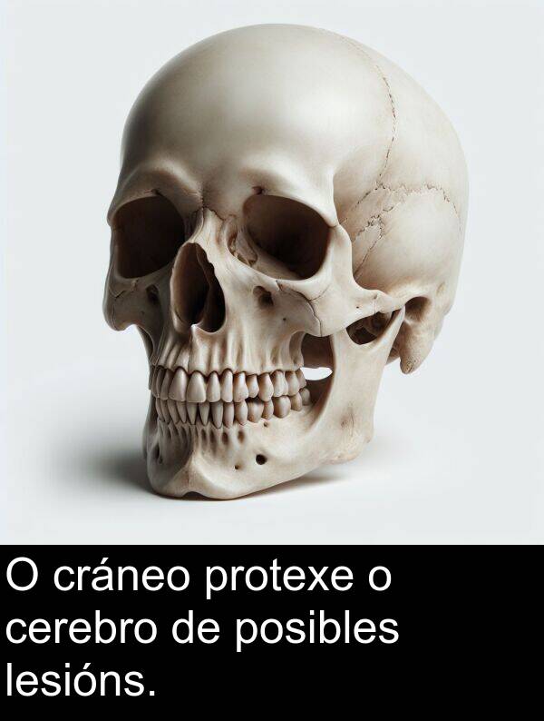 posibles: O cráneo protexe o cerebro de posibles lesións.