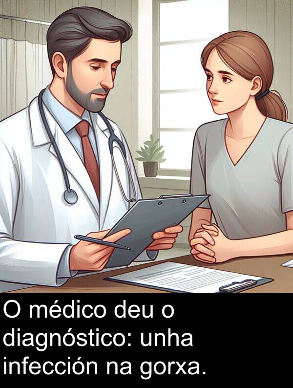 médico: O médico deu o diagnóstico: unha infección na gorxa.