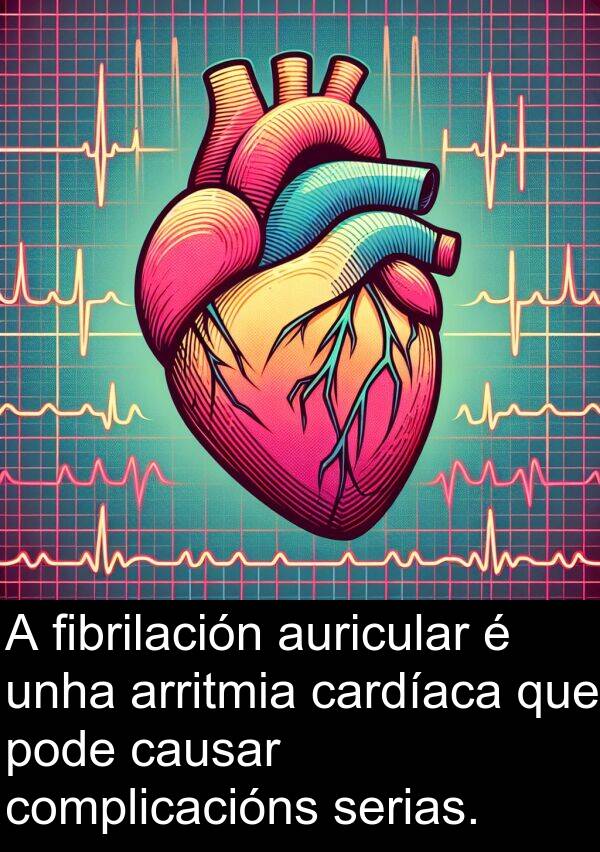 cardíaca: A fibrilación auricular é unha arritmia cardíaca que pode causar complicacións serias.