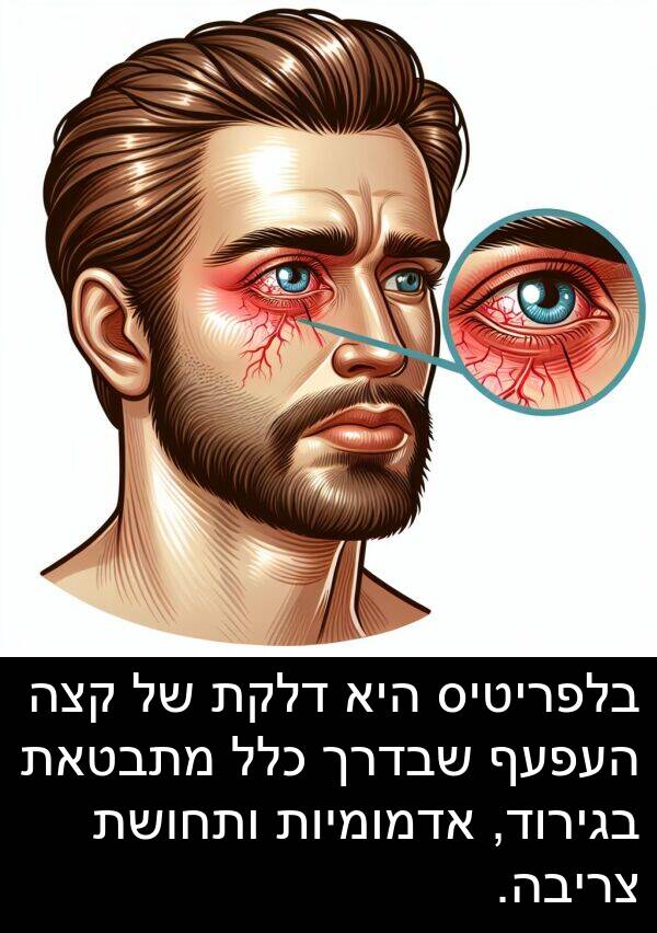 בגירוד: בלפריטיס היא דלקת של קצה העפעף שבדרך כלל מתבטאת בגירוד, אדמומיות ותחושת צריבה.