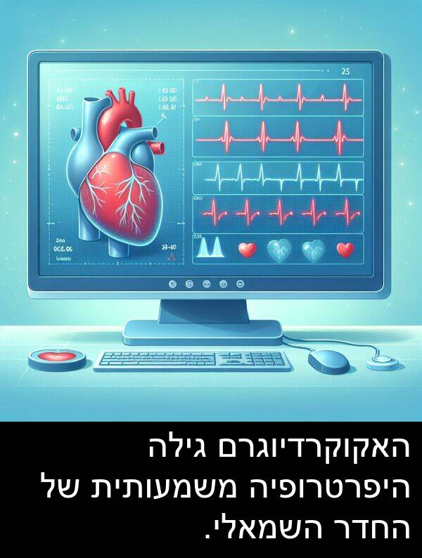 גילה: האקוקרדיוגרם גילה היפרטרופיה משמעותית של החדר השמאלי.
