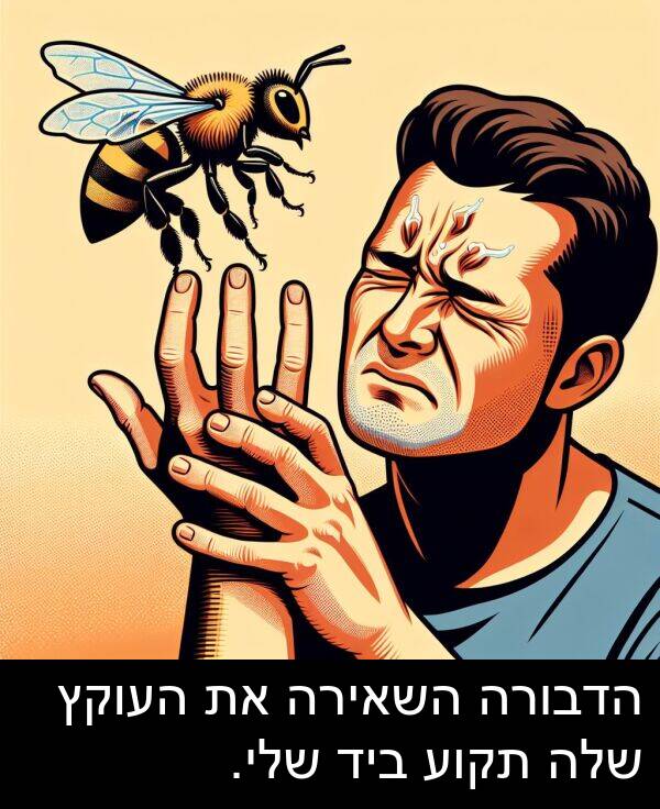 תקוע: הדבורה השאירה את העוקץ שלה תקוע ביד שלי.