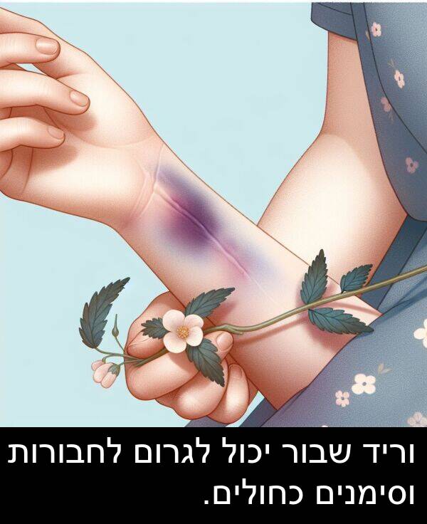 שבור: וריד שבור יכול לגרום לחבורות וסימנים כחולים.