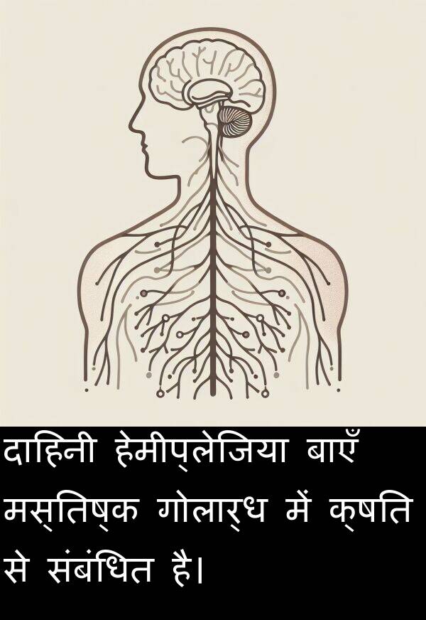 संबंधित: दाहिनी हेमीप्लेजिया बाएँ मस्तिष्क गोलार्ध में क्षति से संबंधित है।