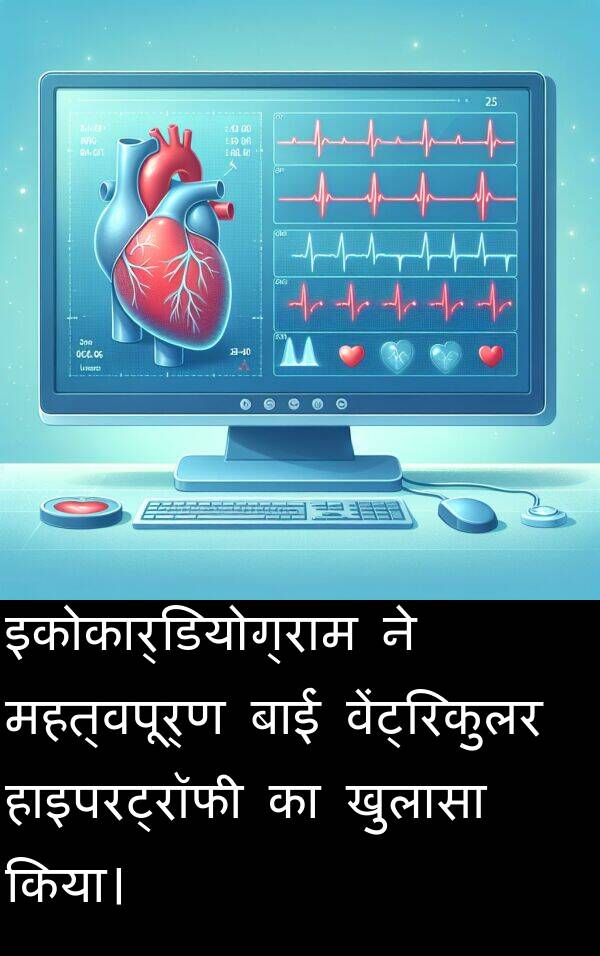 खुलासा: इकोकार्डियोग्राम ने महत्वपूर्ण बाईं वेंट्रिकुलर हाइपरट्रॉफी का खुलासा किया।